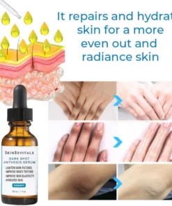 Alternative view of SkinRevitalx® Acanthosis Nigricans Therapy Serum