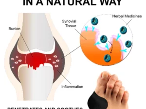StrongJoints Anti Bunion Patches