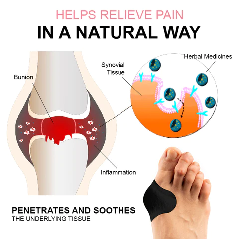 StrongJoints Anti Bunion obliži