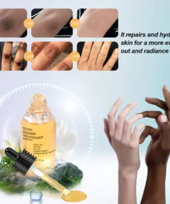 TLOPA Blemish Treatment serum
