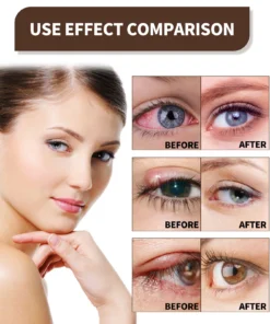 TLOPA™ Ultra Eye Therapy Drops
