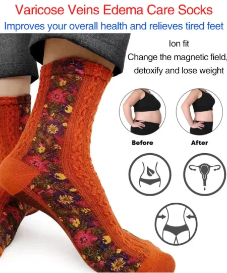 Varicose Veins Edema Care Socks