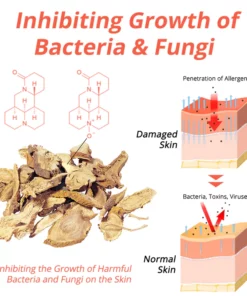 flysmus™ Heat Rash Treatment Cream