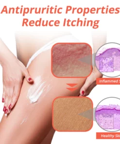 flysmus™ Heat Rash Treatment Cream