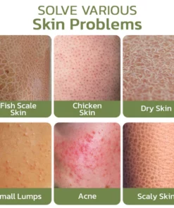 flysmus™ KeratosisTreat Deep Clean Smooth Cream