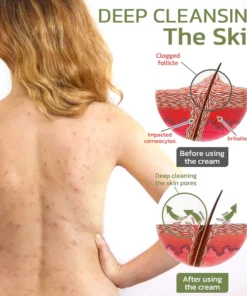 flysmus™ KeratosisTreat Deep Clean Smooth Creme