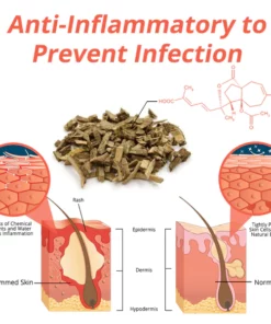 flyus™ Heat Rash Treatment Cream