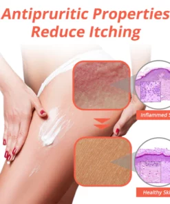 flyus™ Heat Rash Treatment Cream