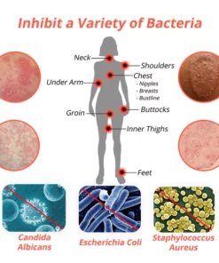 flyus™ Heat Rash Treatment Cream