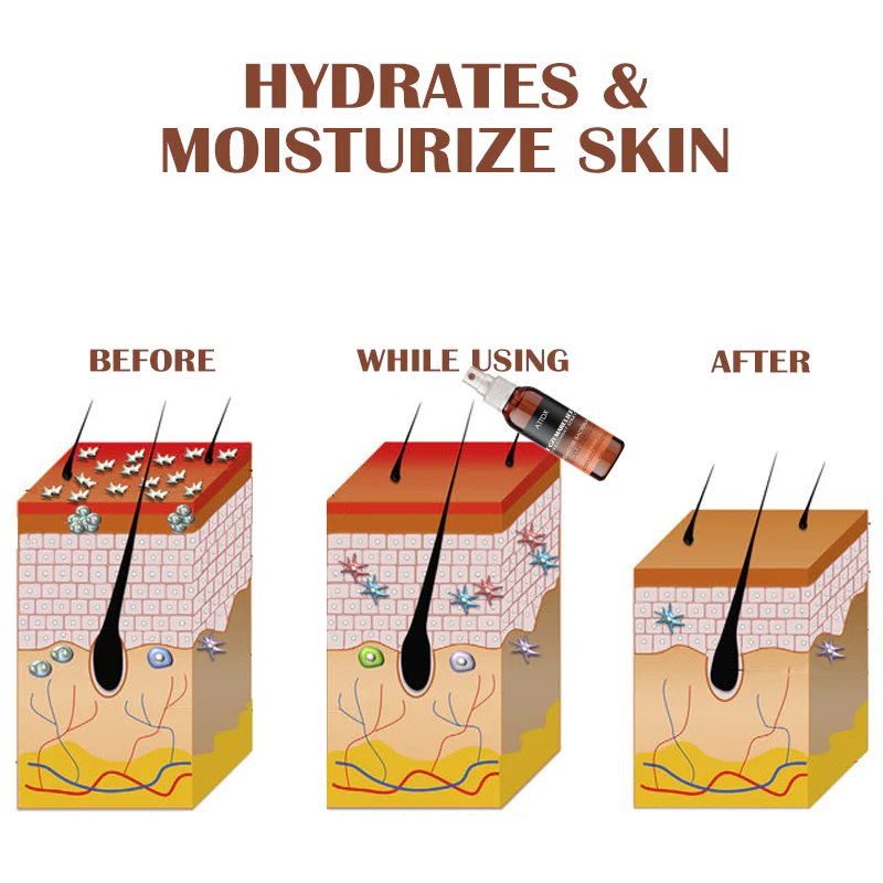 ATTDX EczemaRelief Treatment Spray - Image 5