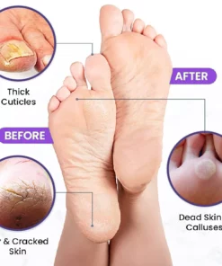 Alternative view of ATTDX FootCorn Calluses Lavender PeelMask