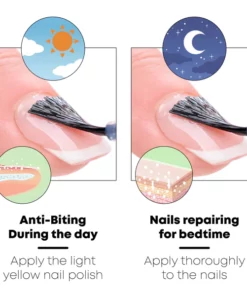 Alternative view of ATTDX QuitNail Biting Treatment Bitter Polish