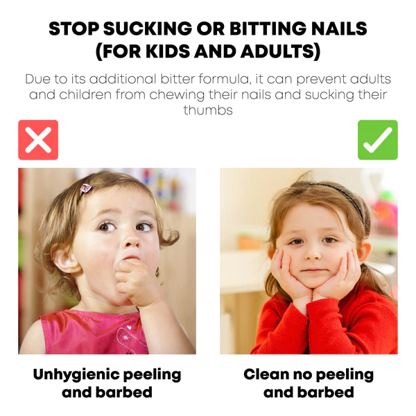 Supwell Nail Biting Treatment For Kids - Nail Polish To Help Thumb Sucking  Stop For Kids and Biting Nails, Bitter Taste, Safe & Effective, Easy To  Apply,15ML price in Saudi Arabia |
