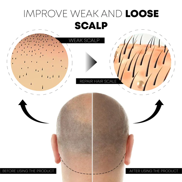 ATTDX ScalpFolliculitis Relief TherapyOil - Image 7