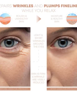 ATTDX WrinkleRepair Bio Silicone Overnight Tape