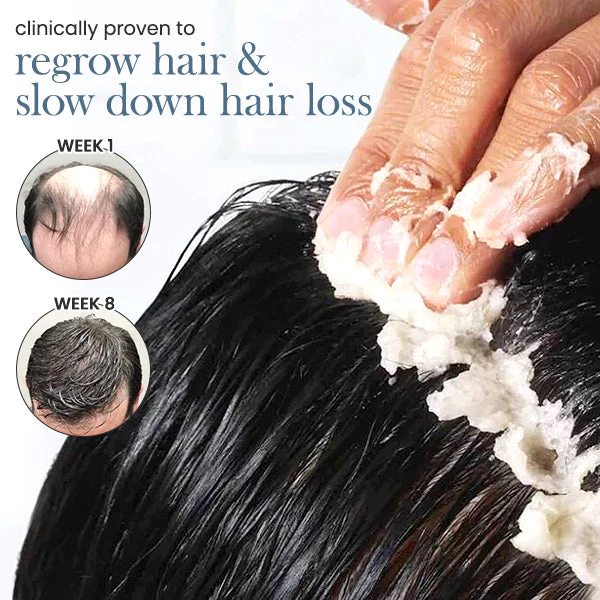 Exfoliant per al cabell Blusoms™ RootRestore