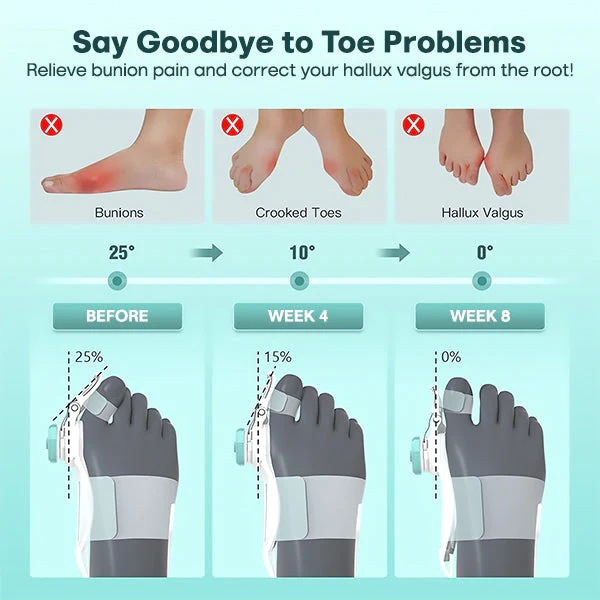Blusoms™ Japanese Hallux Corrector - Image 3