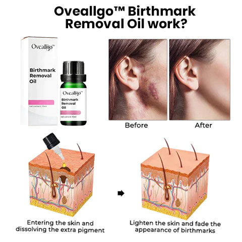 CC™ Birthmark Retire lwil oliv