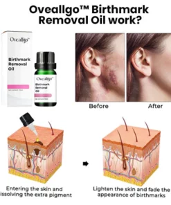 CC™ Birthmark Removal Oil