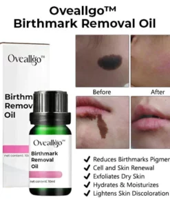 CC™ Birthmark Removal Oil