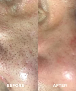 EIASER™ Perilla Bamboo Charcoal Cleaning Jelly