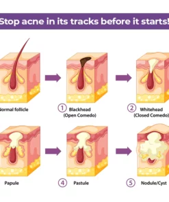 EIASER™ Perilla Bamboo Charcoal Cleaning Jelly