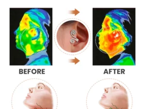 Ears Acupressure Slimming Earrings