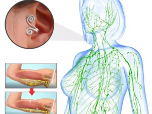 Ears Acupressure Slimming Earrings