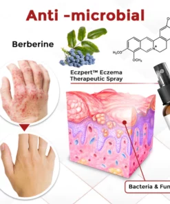 Eczpert™ Eczema Therapeutic Spray
