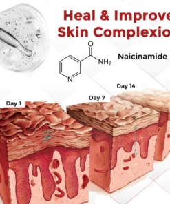 Eczpert™ Eczema Therapeutic Spray