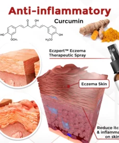 Eczpert™ Eczema Therapeutic Spray