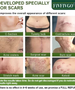 Alternative view of Fivfivgo™ Advanced Scar Repair Serum für alle Arten von Narben