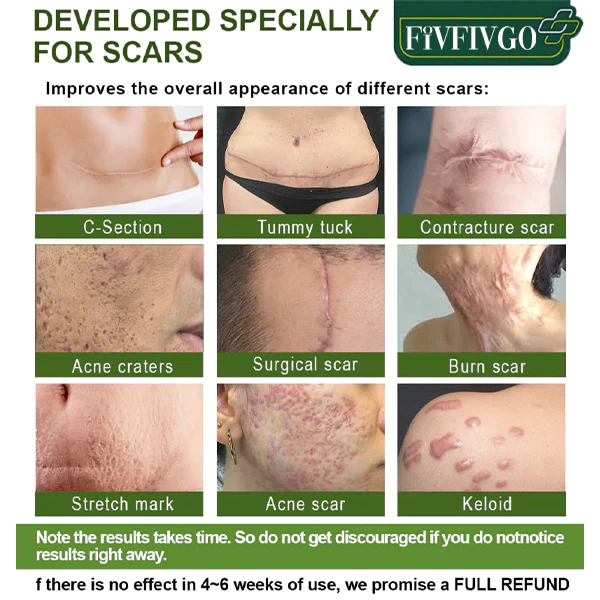 Fivfivgo™ Advanced Scar Repair Serum für alle Arten von Narben - Image 2