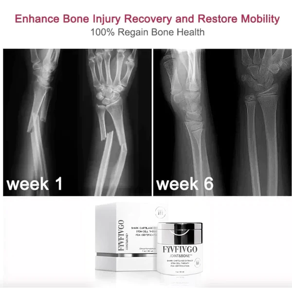 Fivfivgo™ Joint&Bone Haifischknorpel-Stammzellencreme - Image 4