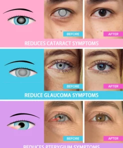 Fivfivgo™ REBRIGHT Natürliche Kräuterdampf-Augenmaske