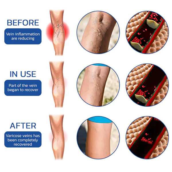 Fivfivgo™ UltraSLIM Tourmaline Ion Body Shaping Stretch-Seidenstrümpfe - Image 4