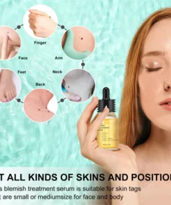 Fivg™ Blemish Treatment Serum