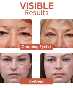 Flashing™ CaffeineEYES Repair and Lifting Eye Cream