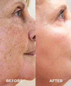 Flashing™ Spot-Off Turmeric Oil