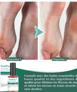 FootPro™ Gel extra-fort pour l'élimination du maïs