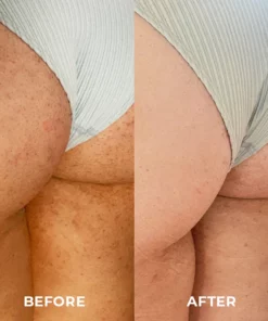 FreshVital™ Niacinamide Blackberry Body Scrub