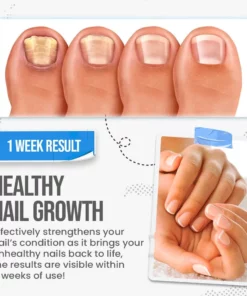 Fungus Shield Nail Treatment Cream