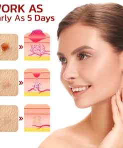 Alternative view of GFOEK™ Tags & Moles Remover