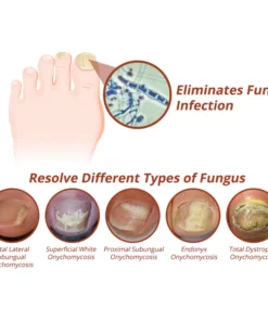 GFOUK™ 7 Days Nail Growth and Strengthening Serum