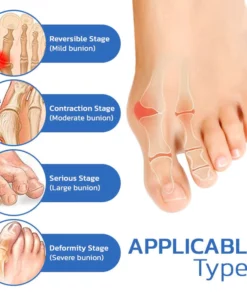 GFOUK™ AntiBunion and VeinHeal Health Socks