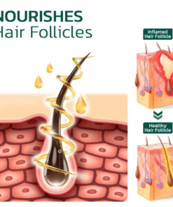 GFOUK™ Scalp Folliculitis Therapy Oil