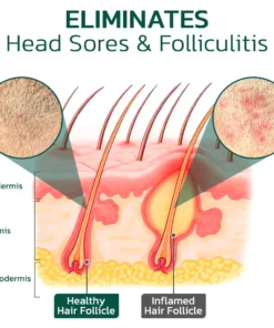 GFOUK™ Scalp Folliculitis Therapy Oil