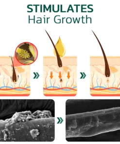 GFOUK™ Scalp Folliculitis Therapy Oil