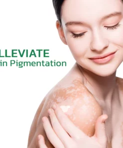 Alternative view of GFOUK™ TreatVitiligo Soothing Cream