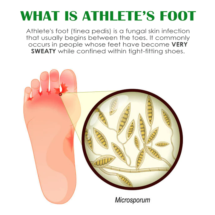 Gutp FreshFeet Debacteria Botanical Spray - Image 2